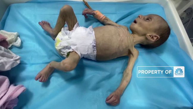 bayi-palestina-melawan-kelaparan_169.png